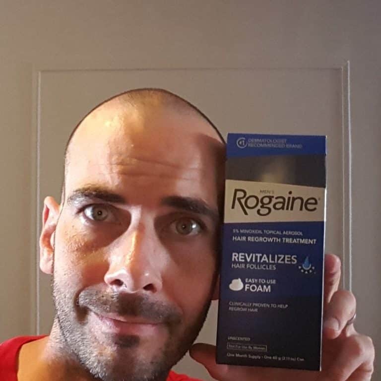 Rogaine Review Must Read This Before Buying