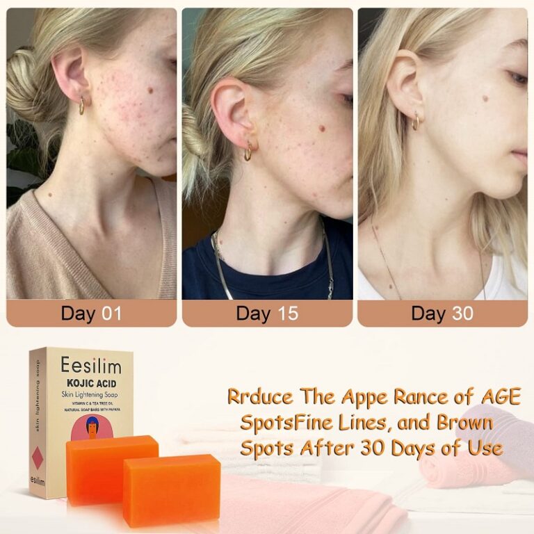 Kojic Acid Soap Before and After Does It Really Lighten Skin? Must