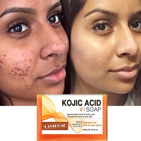 Kojic Acid Soap Before and After: Does It Really Lighten Skin? - Must ...