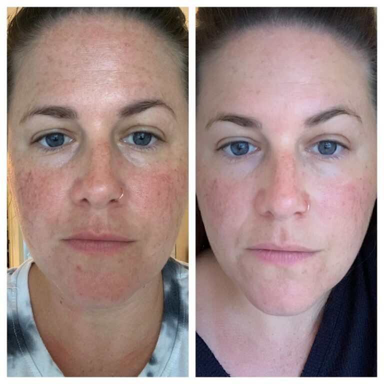 Modere Collagen Before and After: Real Results Revealed - Must Read ...